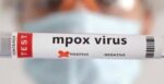 Amazonas e Pará registram casos de mpox